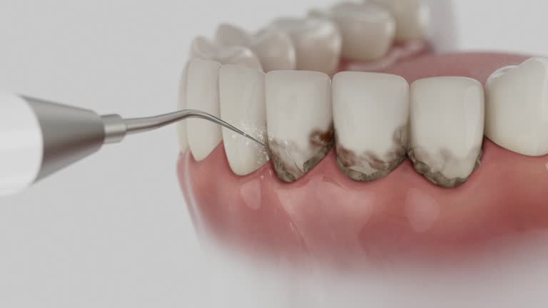 Reliable Dental contractor in Wolf Lake, MI by Smile Center Dentistry